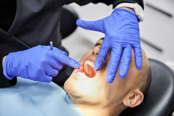 Best Emergency Gum Treatment in Toledo, OH